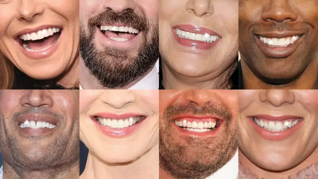That Hollywood smile