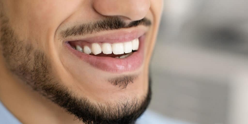 White teeth