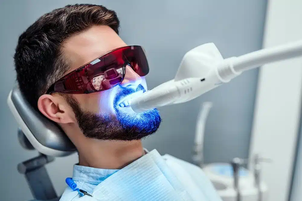 teeth whitening is a normal service nowadays